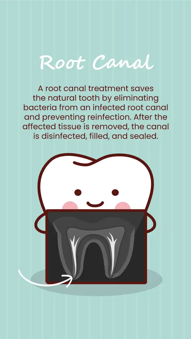 Services  Root Canals