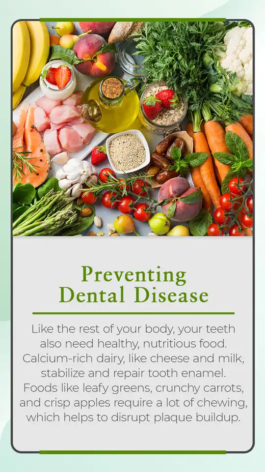 Dental Tips  Nutrition