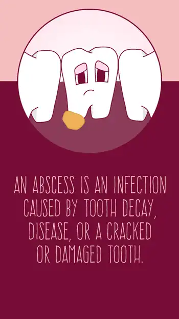 Fact  Abscess