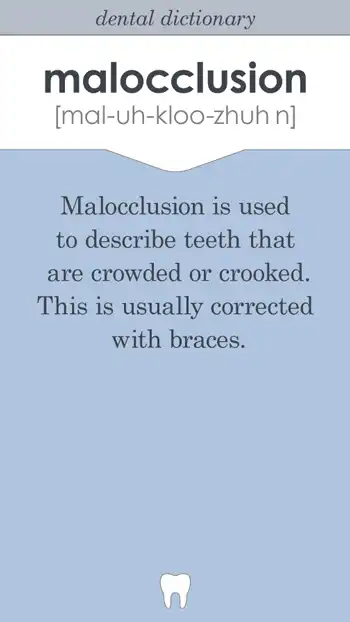Terms  Malocclusion