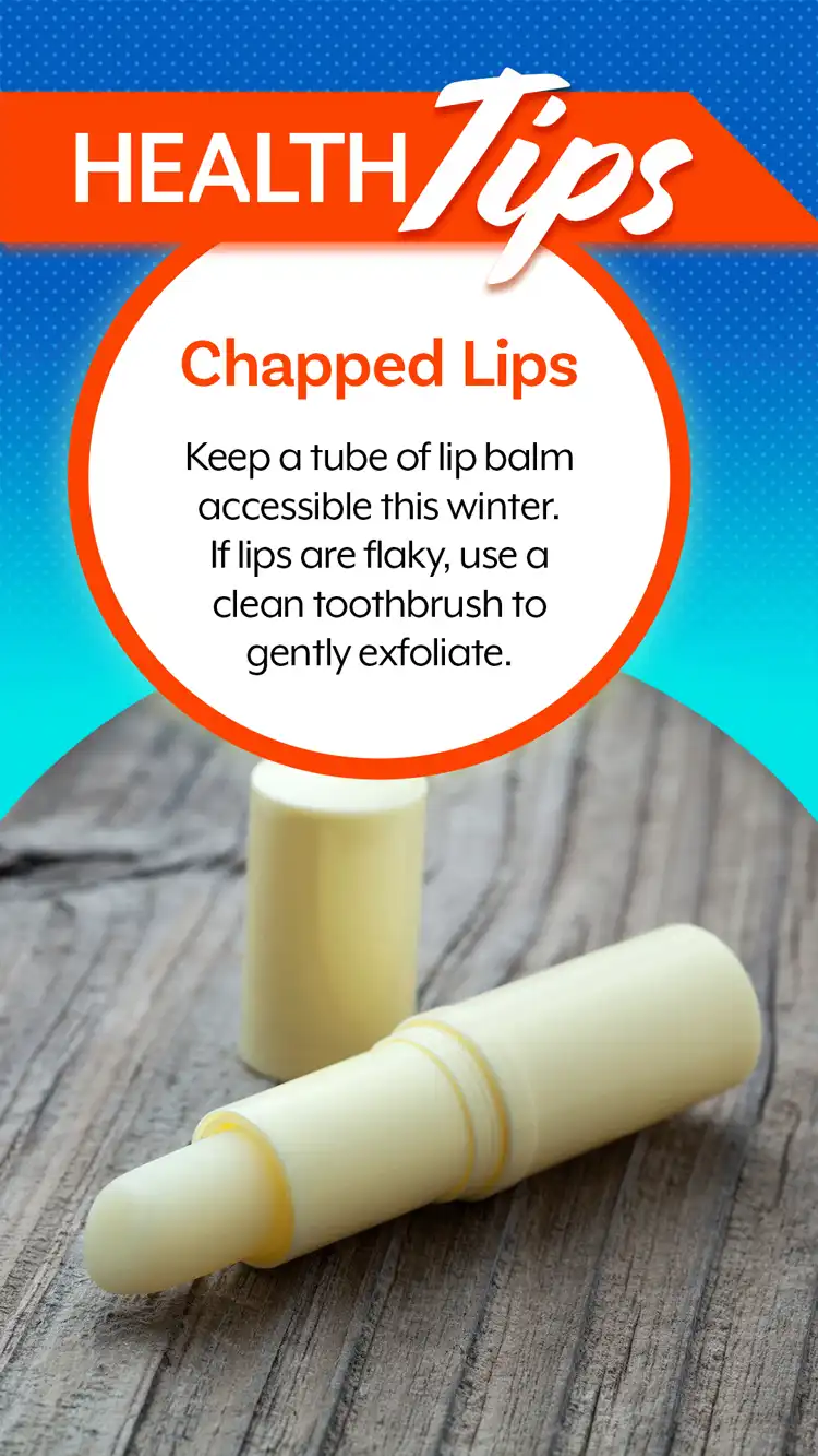 Health Tips  Chapped Lips