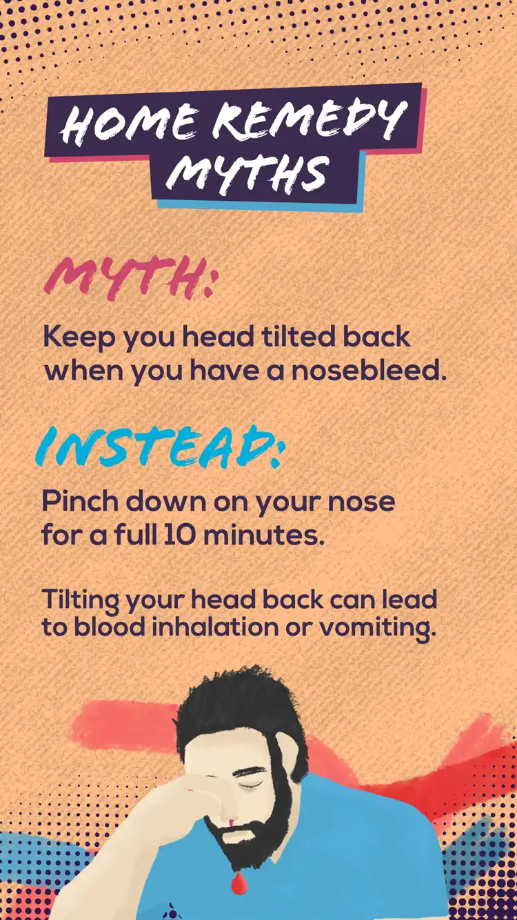 Pharmacy Home Remedy Myths Nosebleed