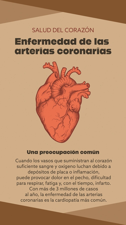 Coronary Artery Disease