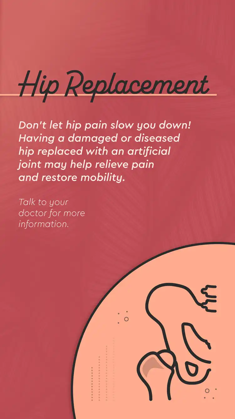 Orthopedic  Hip Replacement Benefits 02