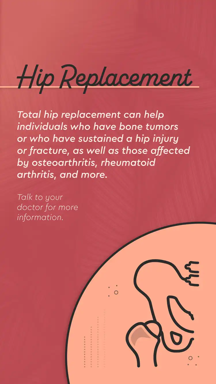 Orthopedic  Hip Replacement Benefits 04