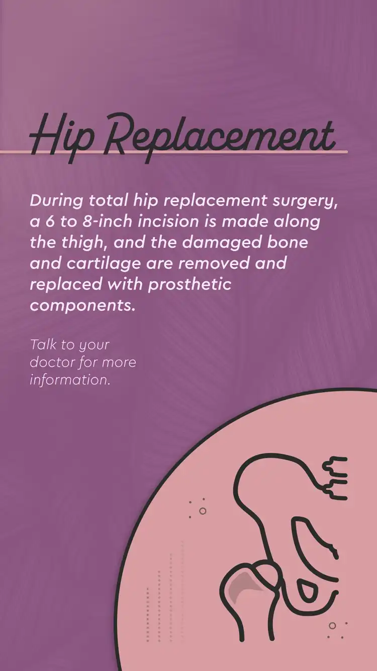 Orthopedic  Hip Replacement Surgery 01