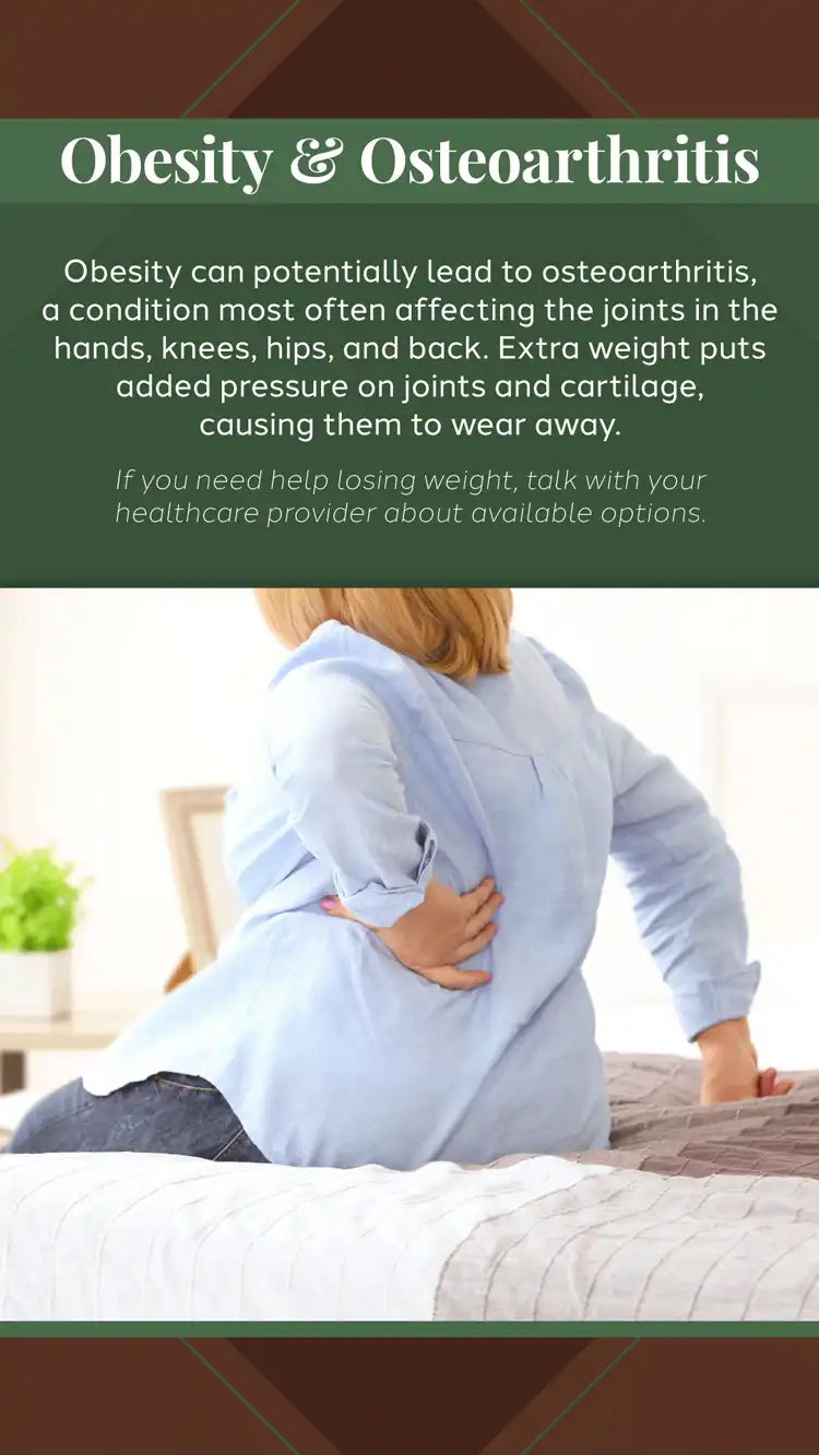 Orthopedic  Obesity Osteoarthritis