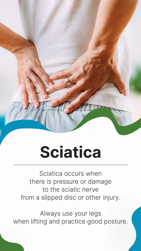 Sciatica