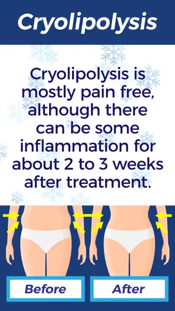 Cryolipolysis Pain Free